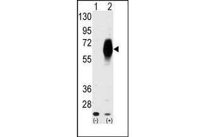 Western blot analysis of AMHR2 (arrow) using AMHR2 Antibody (AMHR2 抗体  (N-Term))
