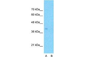 Host:  Rabbit  Target Name:  APOBEC3B  Sample Type:  HepG2  Lane A:  Primary Antibody  Lane B:  Primary Antibody + Blocking Peptide  Primary Antibody Concentration:  1ug/ml  Peptide Concentration:  5ug/ml  Lysate Quantity:  25ug/lane/lane  Gel Concentration:  0.