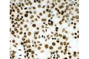 Immunocytochemistry (ICC) image for anti-Minichromosome Maintenance Complex Component 2 (MCM2) (AA 884-904) antibody (ABIN3031803)