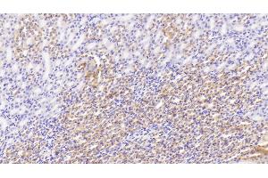 Detection of SDHB in Mouse Kidney Tissue using Polyclonal Antibody to Succinate Dehydrogenase Complex Subunit B (SDHB) (SDHB 抗体  (AA 97-282))