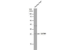 WB Image Human tissue extract (30 μg) was separated by 12% SDS-PAGE, and the membrane was blotted with GSTM1 antibody , diluted at 1:1000.