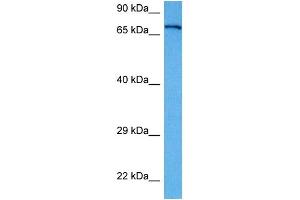 Host:  Rabbit  Target Name:  APP  Sample Tissue:  Human A172 Whole Cell lysates  Antibody Dilution:  1ug/ml (APP 抗体  (Middle Region))