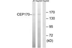 Western blot analysis of extracts from HepG2/Jurkat cells, using CEP170 Antibody. (CEP170 抗体  (AA 701-750))