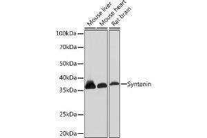 Western blot analysis of extracts of various cell lines, using Syntenin Rabbit mAb (ABIN7270680) at 1:1000 dilution. (SDCBP 抗体)