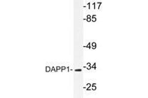 Western blot analysis of DAPP1 antibody in extracts from 293 cells. (DAPP1 抗体)