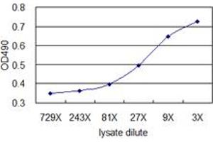 Standard curve using TAGLN 293T overexpression lysate (non-denatured) as an analyte. (TAGLN (人) Matched Antibody Pair)