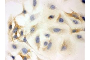 ICC testing of HeLa cells with HLA-C antibody. (HLA-C 抗体)