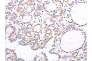 Immunohistochemistry (IHC) image for anti-Transient Receptor Potential Cation Channel, Subfamily C, Member 7 (TRPC7) antibody (ABIN7131495)