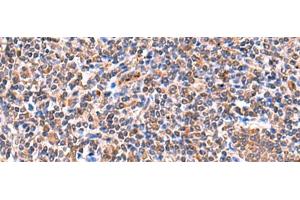 Immunohistochemistry of paraffin-embedded Human tonsil tissue using ISM1 Polyclonal Antibody at dilution of 1:60(x200) (ISM1 抗体)