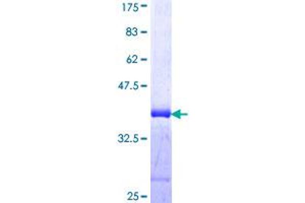 IRX5 Protein (AA 204-264) (GST tag)