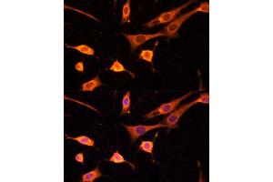 Immunofluorescence (IF) image for anti-Bifunctional Apoptosis Regulator (BFAR) (AA 1-140) antibody (ABIN6137542)