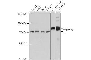 Western blot analysis of extracts of various cell lines, using SNW1 antibody (ABIN7270386) at 1:1000 dilution. (SNW1 抗体  (AA 300-536))