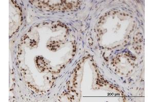 Immunoperoxidase of monoclonal antibody to NUPL1 on formalin-fixed paraffin-embedded human prostate. (NUPL1 抗体  (AA 323-422))
