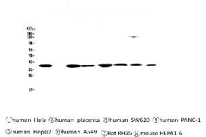 Western blot analysis of SMN1/2 using anti-SMN1/2 antibody . (SMN1 / SMN2 (AA 22-52), (N-Term) 抗体)