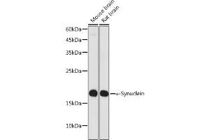 Western blot analysis of extracts of various cell lines, using α-Synuclein antibody (ABIN7270695) at 1:1000 dilution. (SNCA 抗体  (AA 59-140))