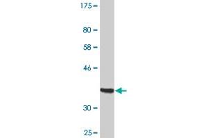 Western Blot detection against Immunogen (37.