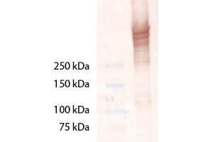 Western Blot analysis of Laminin 5. (Laminin 5 抗体)