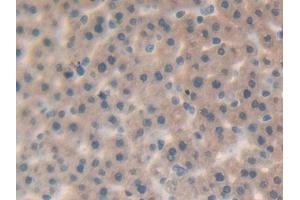 DAB staining on IHC-P; Samples: Rat Liver Tissue (IL-25 抗体  (AA 33-169))