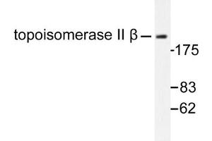 Image no. 1 for anti-Topoisomerase (DNA) II beta 180kDa (TOP2B) antibody (ABIN271965) (TOP2B 抗体)