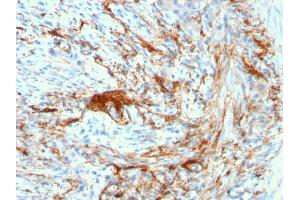 Formalin-fixed, paraffin-embedded human Small Intestine stained with Rabbit Recombinant Monoclonal Antibody (ELN/3131R) to Elastin. (Recombinant Elastin 抗体)