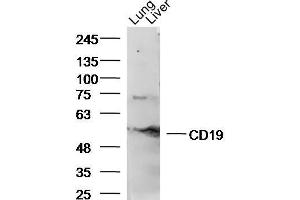 Western Blotting (WB) image for anti-CD19 Molecule (CD19) (AA 151-250) antibody (ABIN1387313)