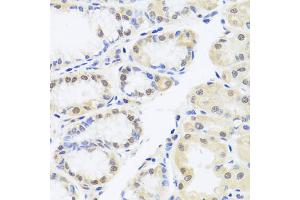 Immunohistochemistry of paraffin-embedded human stomach using RUNX1 antibody (ABIN6291786) at dilution of 1:100 (40x lens).