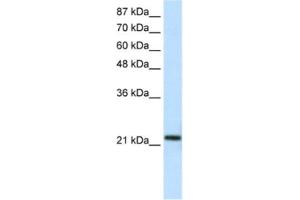 Western Blotting (WB) image for anti-High-Mobility Group Box 1-Like 10 (HMG1L10) antibody (ABIN2461320) (HMG1L10 抗体)