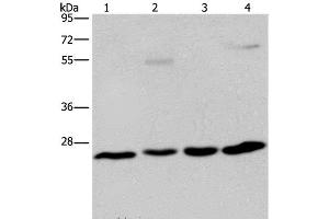 Western Blot analysis of A549 cell and Human hepatocellular carcinoma, Mouse liver tissue and HT-29 cell using ETHE1 Polyclonal Antibody at dilution of 1:400 (ETHE1 抗体)