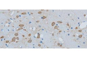 Immunohistochemistry of paraffin-embedded Mouse brain using TIMP4 Polyclonal Antibody at dilution of 1:50 (TIMP4 抗体)
