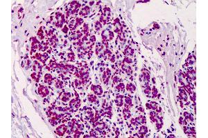 Anti-Poly ADP-Ribose antibody IHC of human breast. (Poly-ADP-Ribose 抗体)
