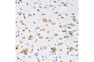 Immunohistochemistry of paraffin-embedded mouse brain using COPB2 antibody. (COPB2 抗体)