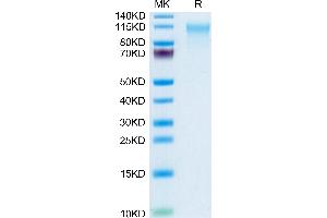 Human CD164 on Tris-Bis PAGE under reduced condition. (CD164 Protein (CD164) (AA 24-162) (Fc Tag))