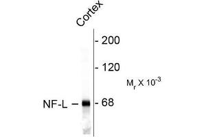 Image no. 1 for anti-Neurofilament, Light Polypeptide (NEFL) antibody (ABIN372673) (NEFL 抗体)