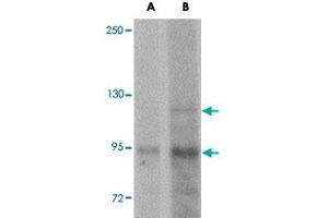 Western blot analysis of KDM3A in mouse liver tissue lysate with KDM3A polyclonal antibody  at (A) 1 and (B) 2 ug/mL . (KDM3A 抗体  (N-Term))