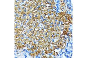 Immunohistochemistry of paraffin-embedded rat ovary using Leptin Receptor Rabbit mAb (ABIN7268210) at dilution of 1:100 (40x lens). (Leptin Receptor 抗体)