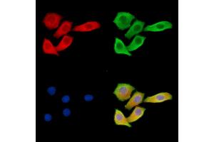 ABIN6263093 and ABIN6279535 staining Hela cells by IF/ICC. (MAP1A 抗体  (Internal Region))