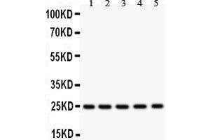 Anti-SOD2 Picoband antibody, Western blotting All lanes: Anti SOD2  at 0. (SOD2 抗体  (C-Term))