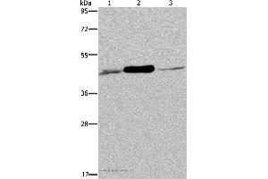 Western blot analysis of 293T and Jurkat cell, human fetal muscle tissue, using IDH2 Polyclonal Antibody at dilution of 1:600 (IDH2 抗体)
