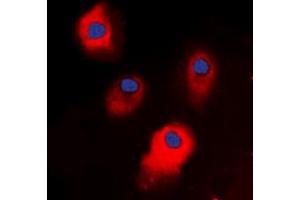 Immunofluorescent analysis of STEAP3 staining in HepG2 cells. (STEAP3 抗体  (C-Term))