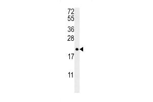 Western Blotting (WB) image for anti-Protein tyrosine Phosphatase Type IVA, Member 2 (PTP4A2) (AA 32-59) antibody (ABIN390820)