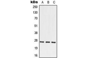 Western blot analysis of PRRX2 expression in HEK293T (A), SP2/0 (B), PC12 (C) whole cell lysates. (PRRX2 抗体  (N-Term))