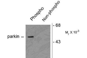 Image no. 1 for anti-Parkinson Protein 2, E3 Ubiquitin Protein Ligase (Parkin) (PARK2) (pSer378) antibody (ABIN372698) (Parkin 抗体  (pSer378))