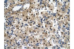 SQLE antibody was used for immunohistochemistry at a concentration of 4-8 ug/ml to stain Hepatocytes (arrows) in Human Liver. (SQLE 抗体  (C-Term))