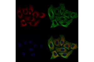ABIN6257484 and ABIN6274780 staining HepG2 cells by IF/ICC. (RPL35 抗体  (C-Term))