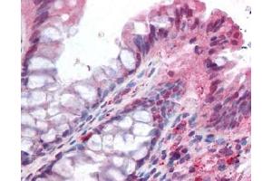 Image no. 1 for anti-NADPH Oxidase Organizer 1 (NOXO1) (AA 238-252) antibody (ABIN401322) (NOXO1 抗体  (AA 238-252))
