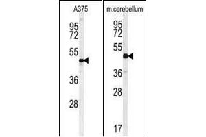 (LEFT)Western blot analysis of C10orf46 Antibody (C-term) (ABIN651189 and ABIN2840118) in  cell line lysates (35 μg/lane). (CACUL1 抗体  (C-Term))