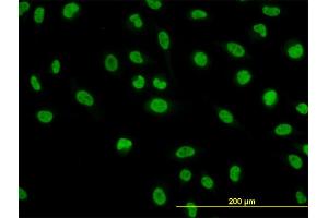 Immunofluorescence of monoclonal antibody to NFIC on HeLa cell.