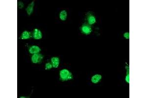 Anti-PDE4B mouse monoclonal antibody (ABIN2454961) immunofluorescent staining of COS7 cells transiently transfected by pCMV6-ENTRY PDE4B (RC211956). (PDE4B 抗体)