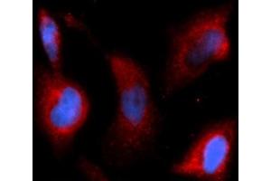 Immunofluorescence (IF) image for anti-Transforming Growth Factor, beta 1 (TGFB1) (AA 279-390) antibody (APC) (ABIN5566209) (TGFB1 抗体  (AA 279-390) (APC))