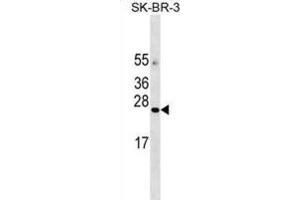 Western Blotting (WB) image for anti-Angiotensin II Receptor-Associated Protein (AGTRAP) antibody (ABIN3000225) (AGTRAP 抗体)